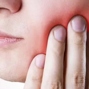 Extraction des dents de sagesse : déroulement et récupération