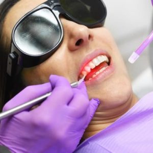 Chirurgie dentaire au laser : quels avantages ?