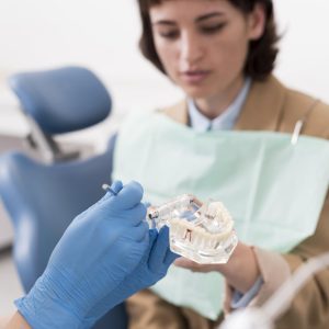Implants dentaires à Rabat: retrouver ses dents perdues grâce à une solution fiable et durable